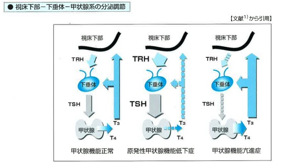 東ソー 血中異常細胞