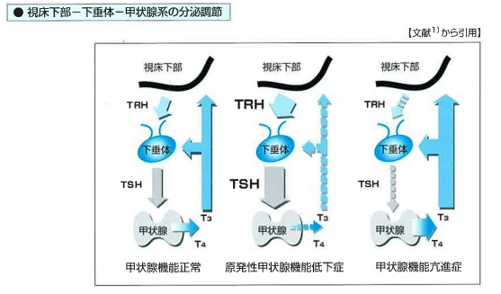 Thyroid Top | https://www.diagnostics.jp.tosohbioscience.com